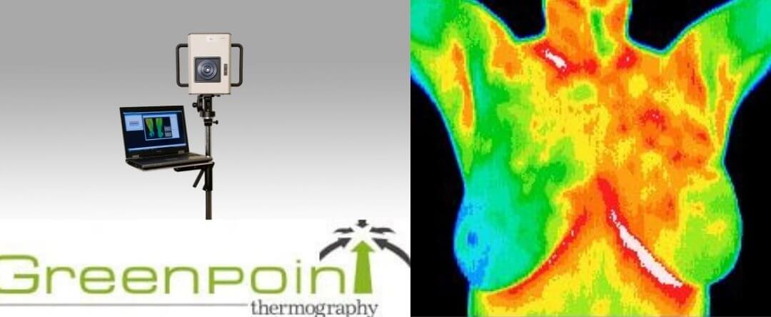 Thermography: An Option for Breast Health Offered at The WellCome OM Integral Healing and Education Center